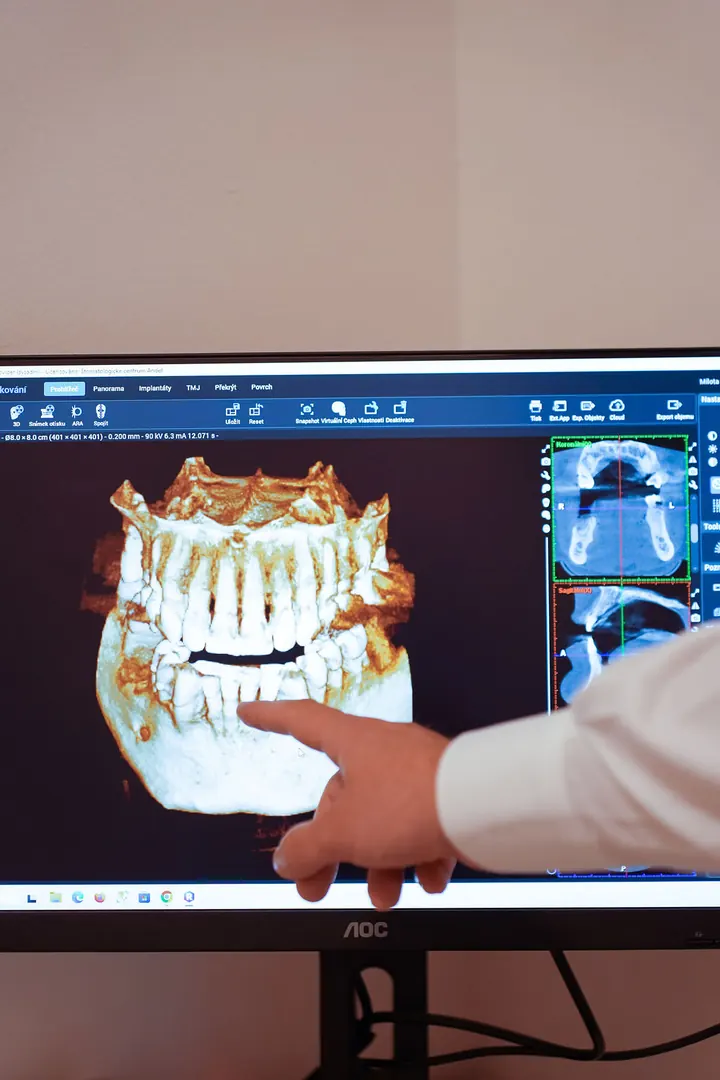 Lékař ukazuje 3D snímek čelistí z CBCT na monitoru