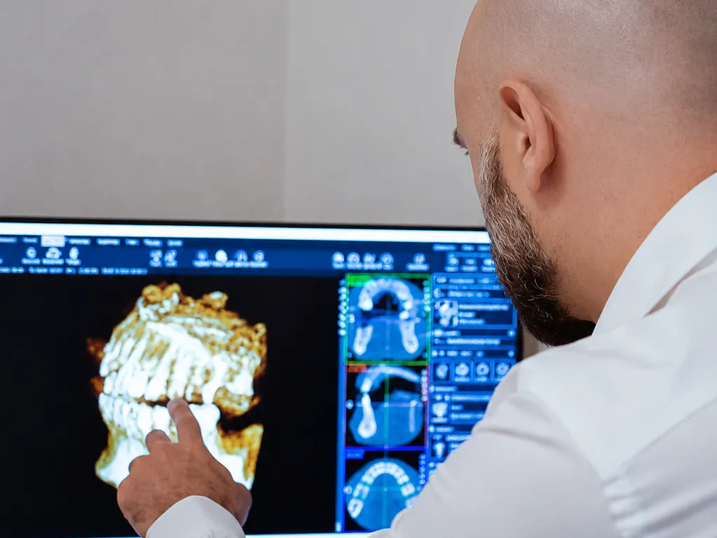Zubní lékař prochází 3D snímek CBCT při plánování léčby